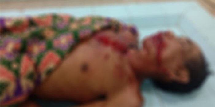 Korban Alani (61) saat berada di kamar jenazah.