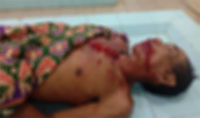 Korban Alani (61) saat berada di kamar jenazah.